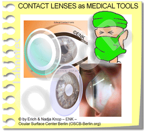 CL as MEDICAL TOOLS