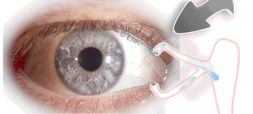 OSCB-HomePage_PUNCTUM-PLUGS,-Lacrimal-Drainage-System_ANIMATION_2_CROP-Schmal-2_35-9-1_.gif
