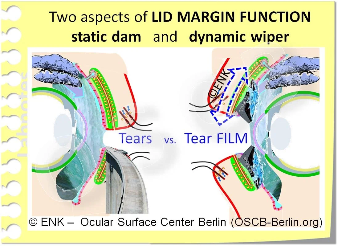 GLIMPSE on the LID MARGIN — Ocular Surface Center Berlin