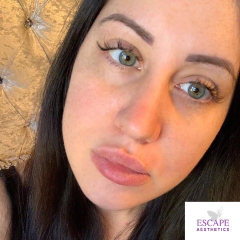 Skin 5-Days With No Makeup After AlumierMD