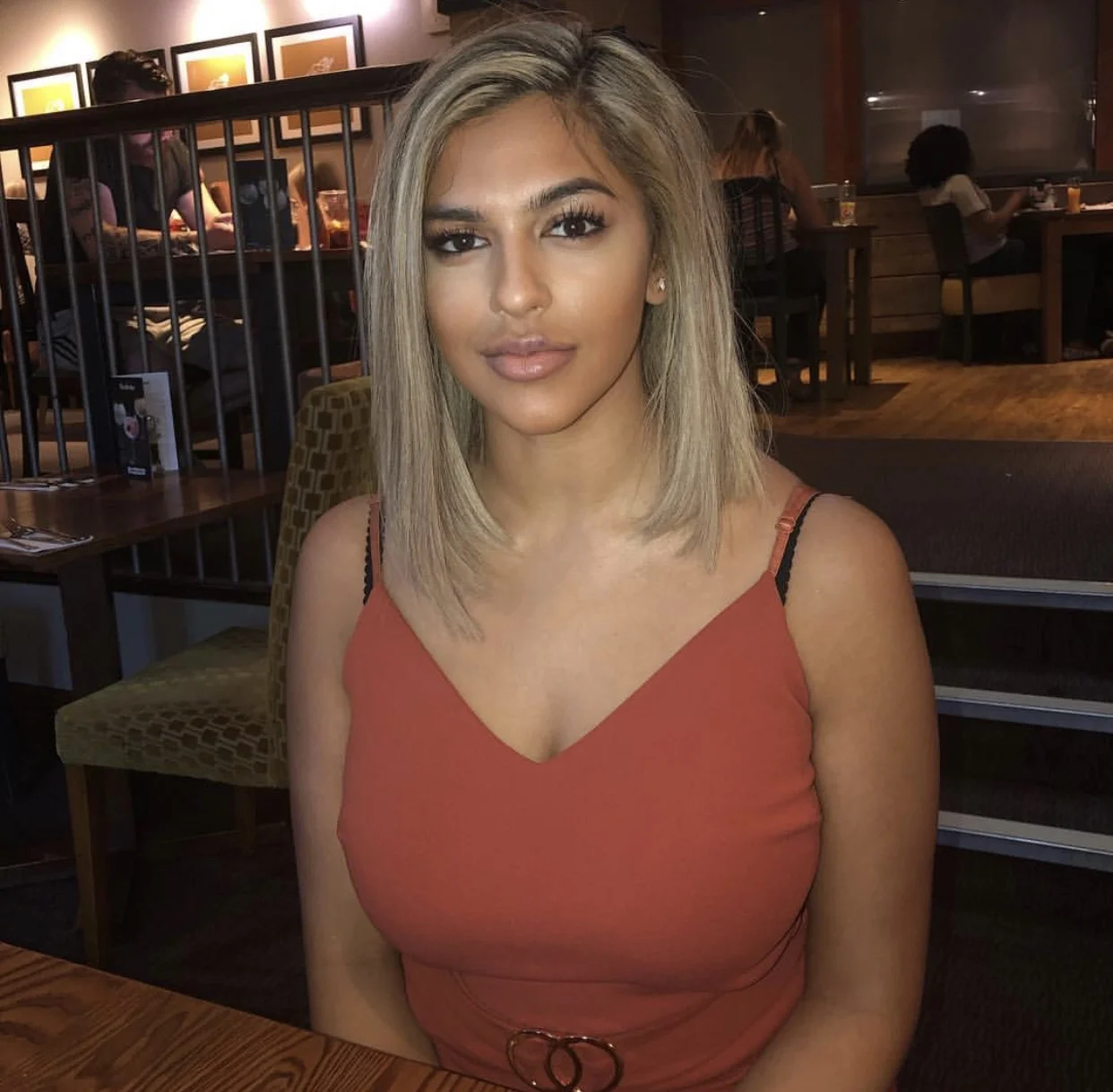 Danielle looking great after her first ever cheek filler treatment