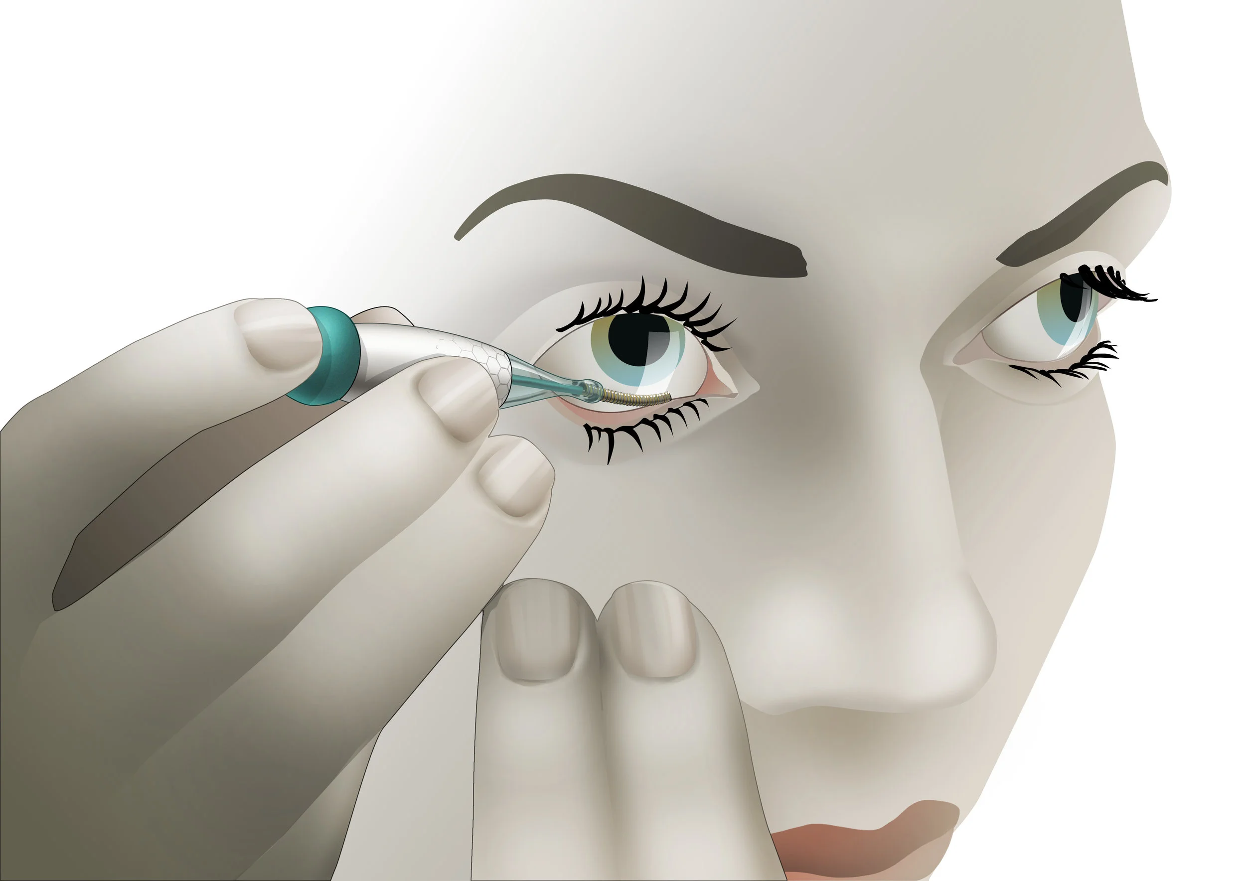The flexible sensor is placed behind the eyelid. It is more comfortable than a contact lens