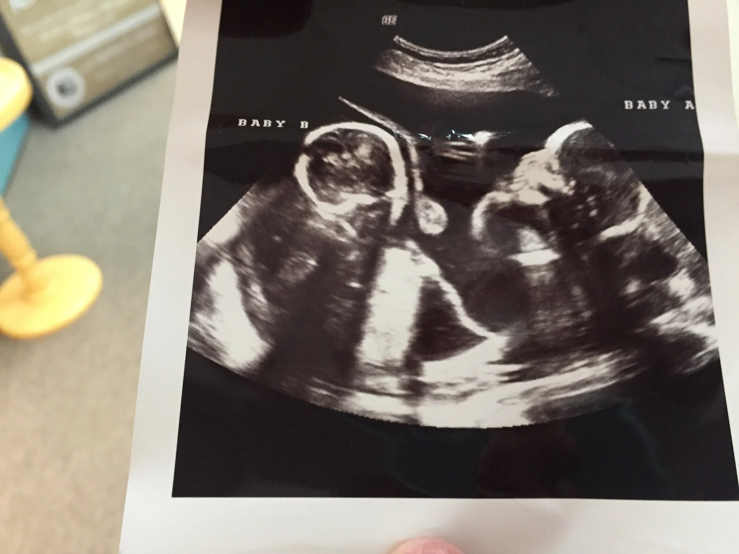 First Fruits Friday - Twins Saved from Abortion