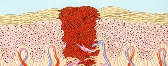 wound healing.jpg