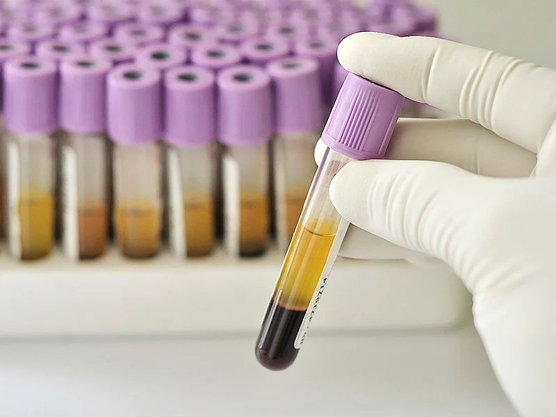 blood_test_tube.jpg