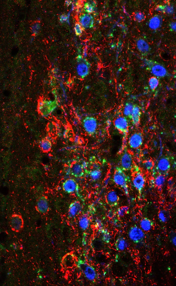 neuromodulators.jpg