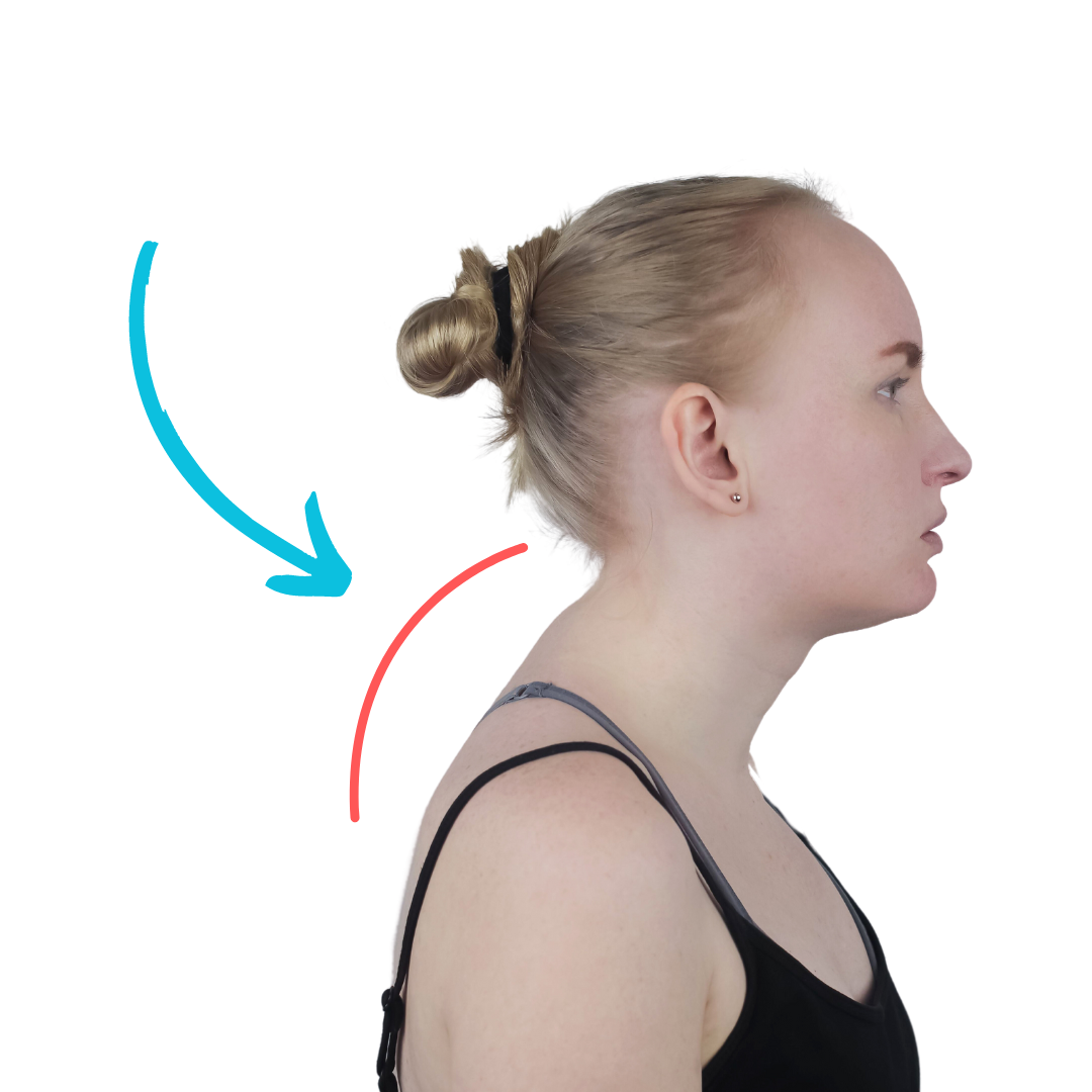 Combatting Dowager's Hump: Prevention and Reduction Techniques for Improved  Posture — Newmarket Chiropractor Dr. Adam Markew