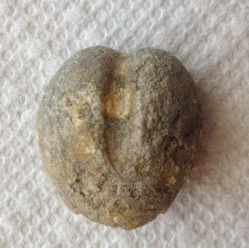 Heteraster texanus #20 Comanche Peak Formation Hood Co., TX