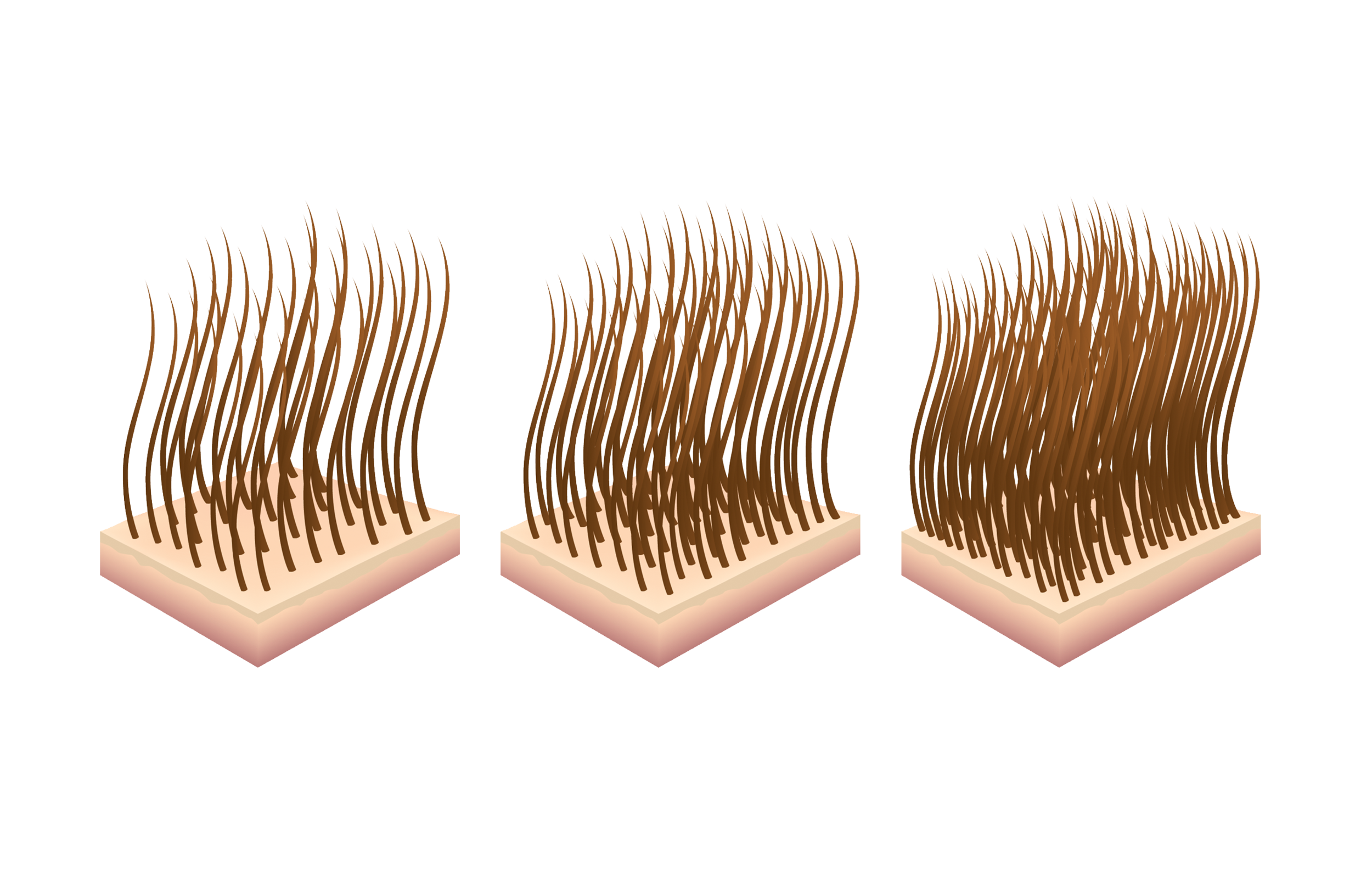 2_hairdensity.png