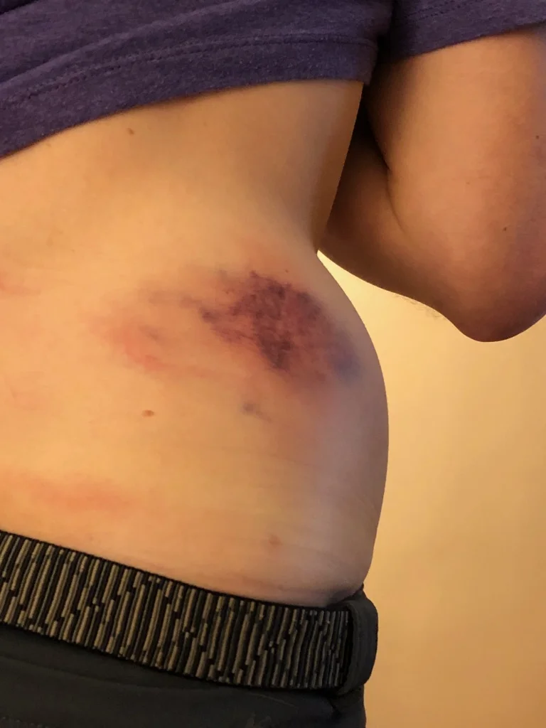 Angry Cernich Speaks Out Against Body Shaming, Reveals Enormous Muffin Top at MonsterCross 2018