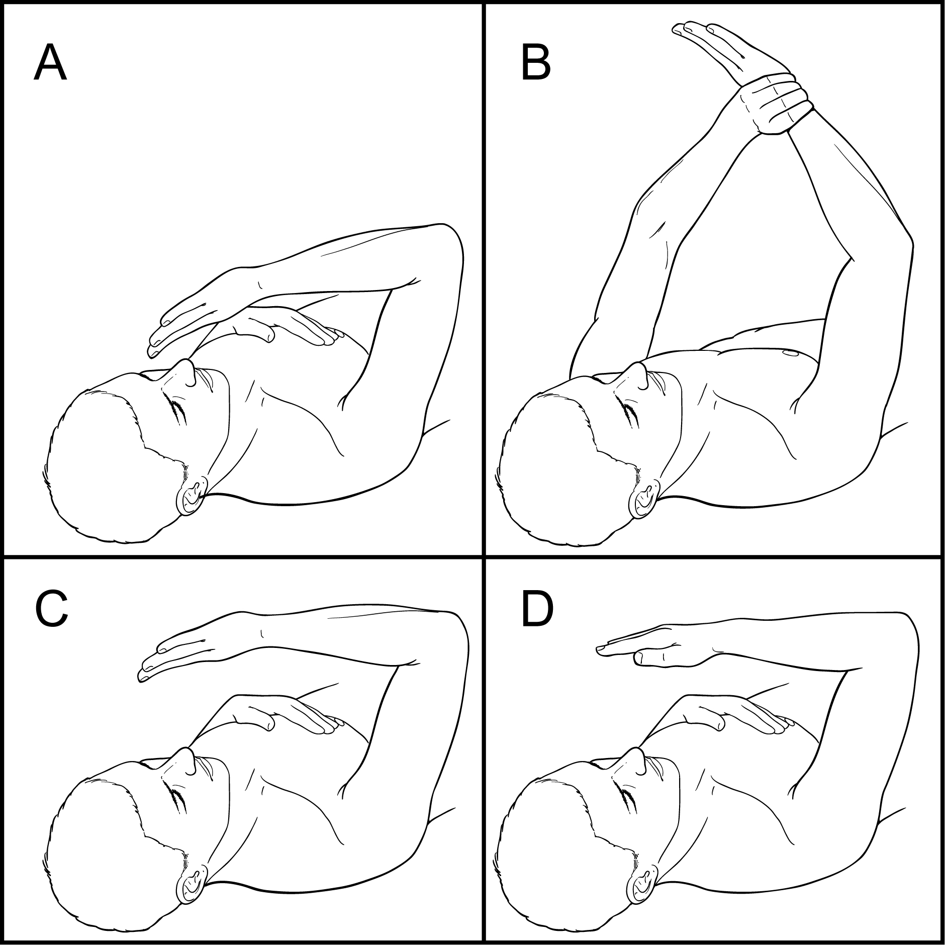 Elbow Dislocation Raleigh Hand Surgery — Joseph J. Schreiber, MD