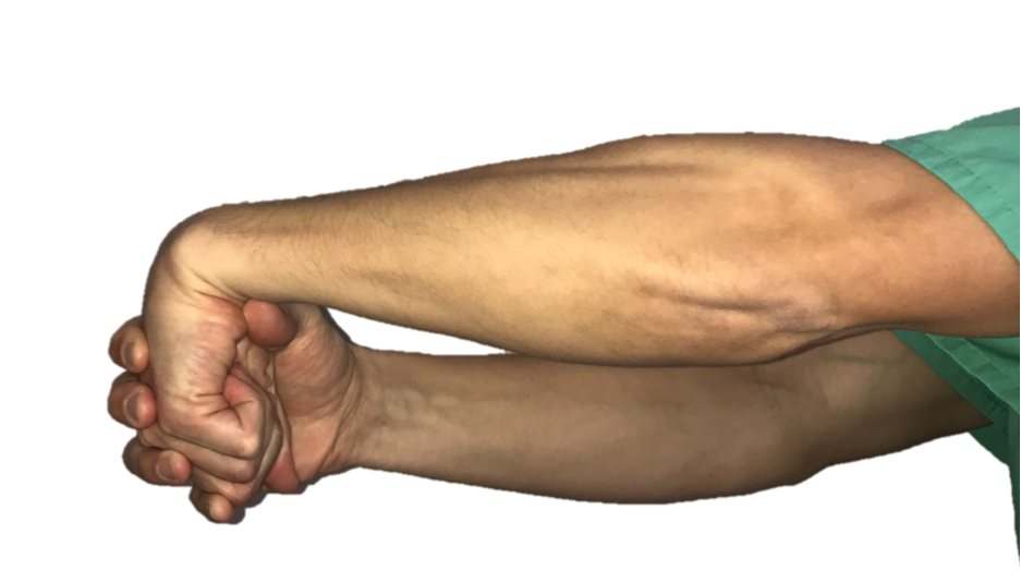 Medial Epicondylitis Golfer's Elbow Raleigh Hand Surgery — Joseph J