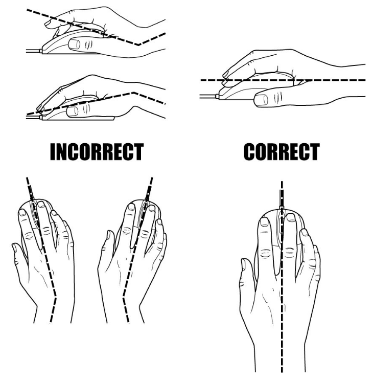 "Can using a computer cause carpal tunnel syndrome?" — Joseph J. Schreiber, MD