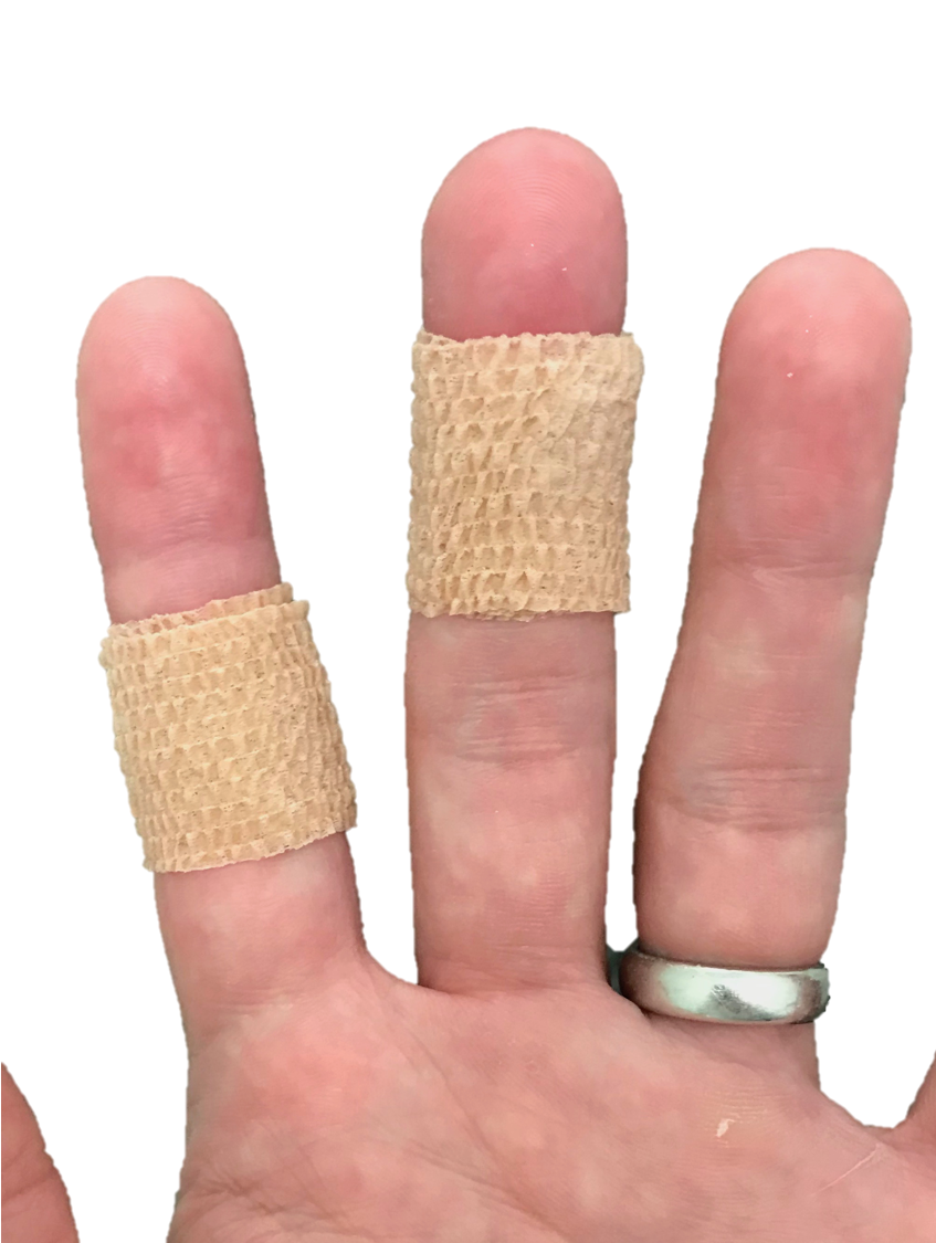 What is Trigger Finger, and What Can I Do About It?