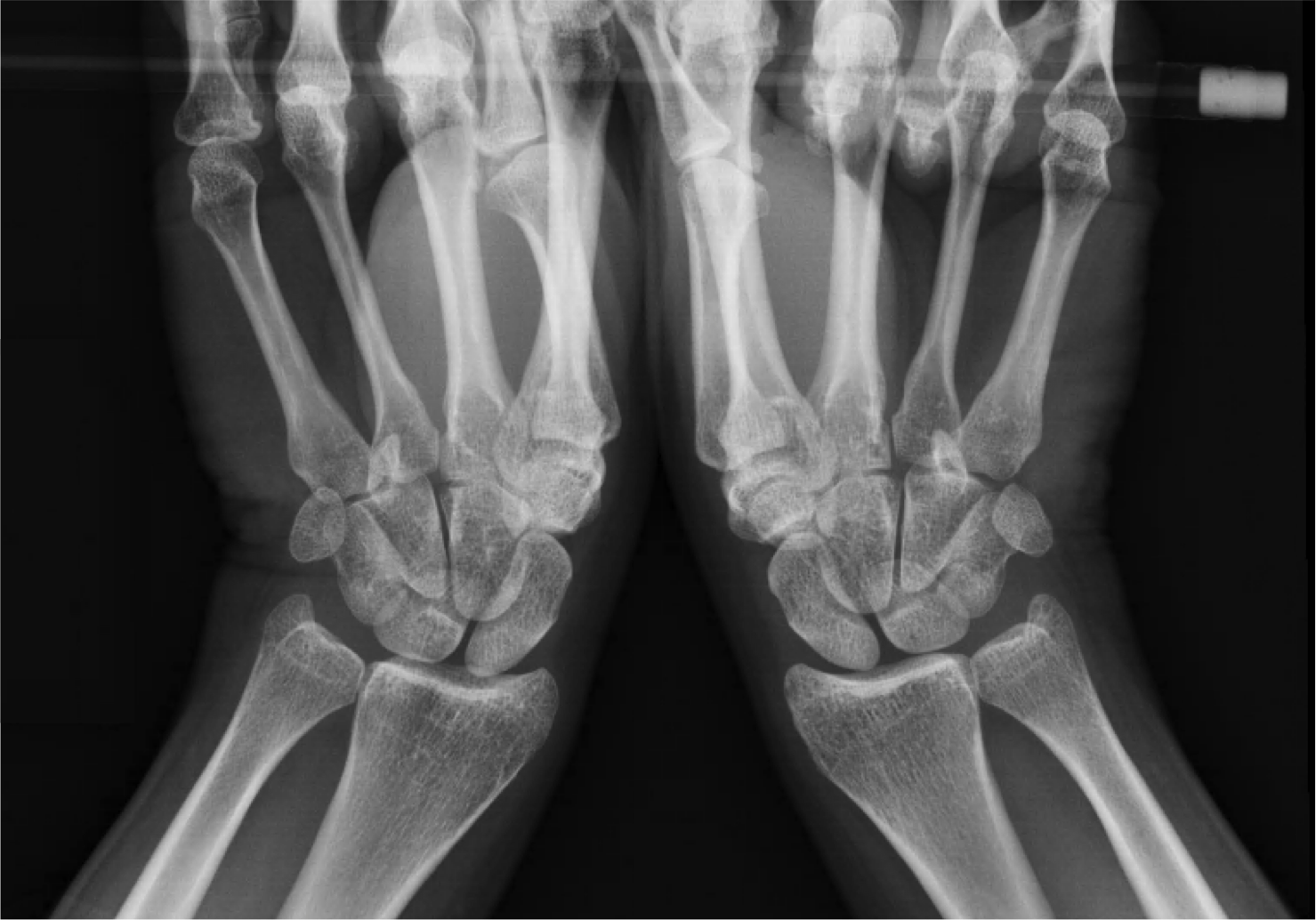 XRays — Joseph J. Schreiber, MD