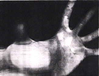 Benji Rosen: Proceso