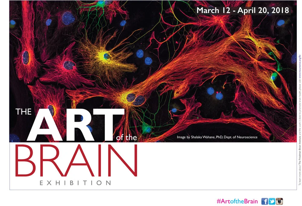 The Art of the Brain Exhibition