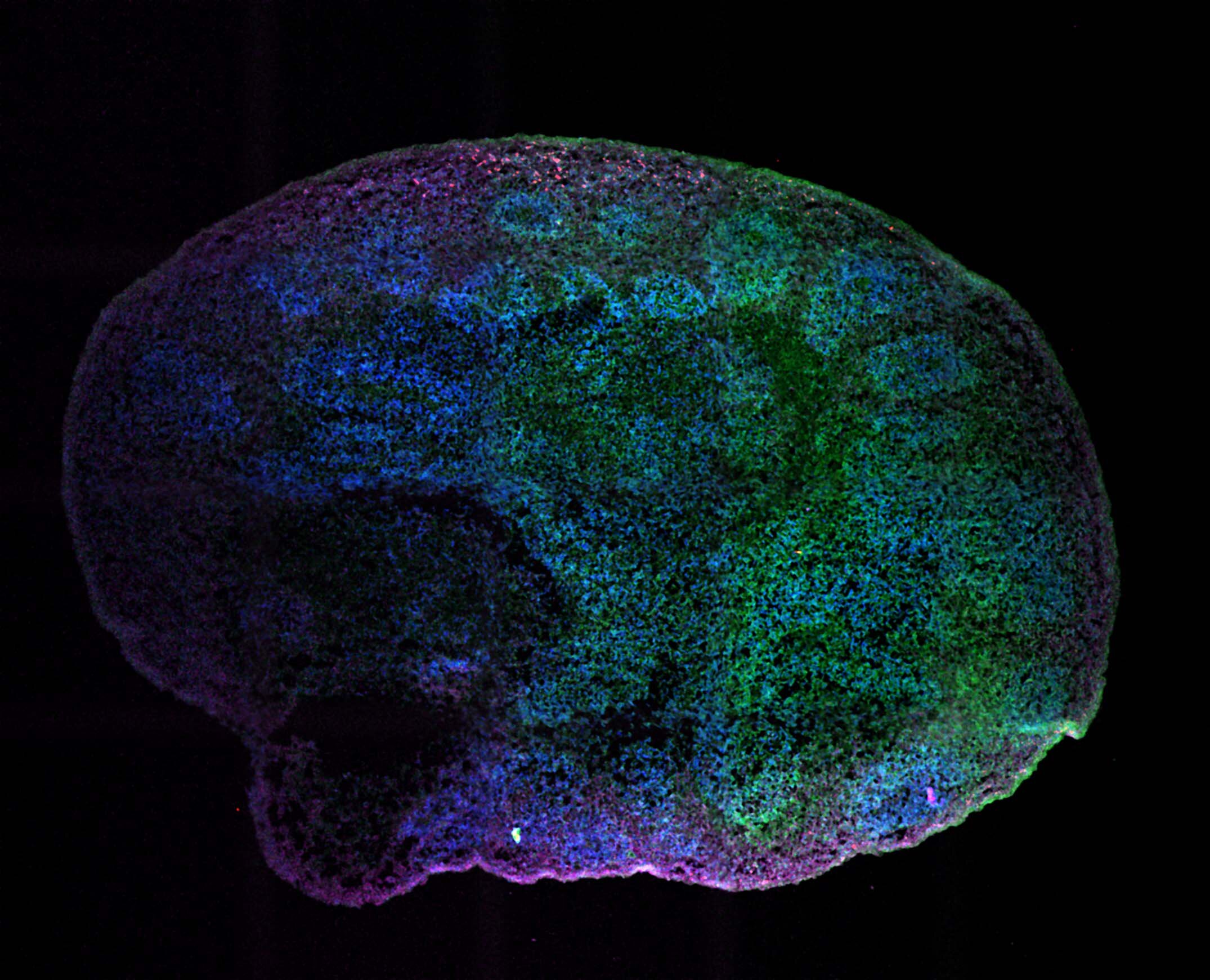 Cerebral Brain Organoid
