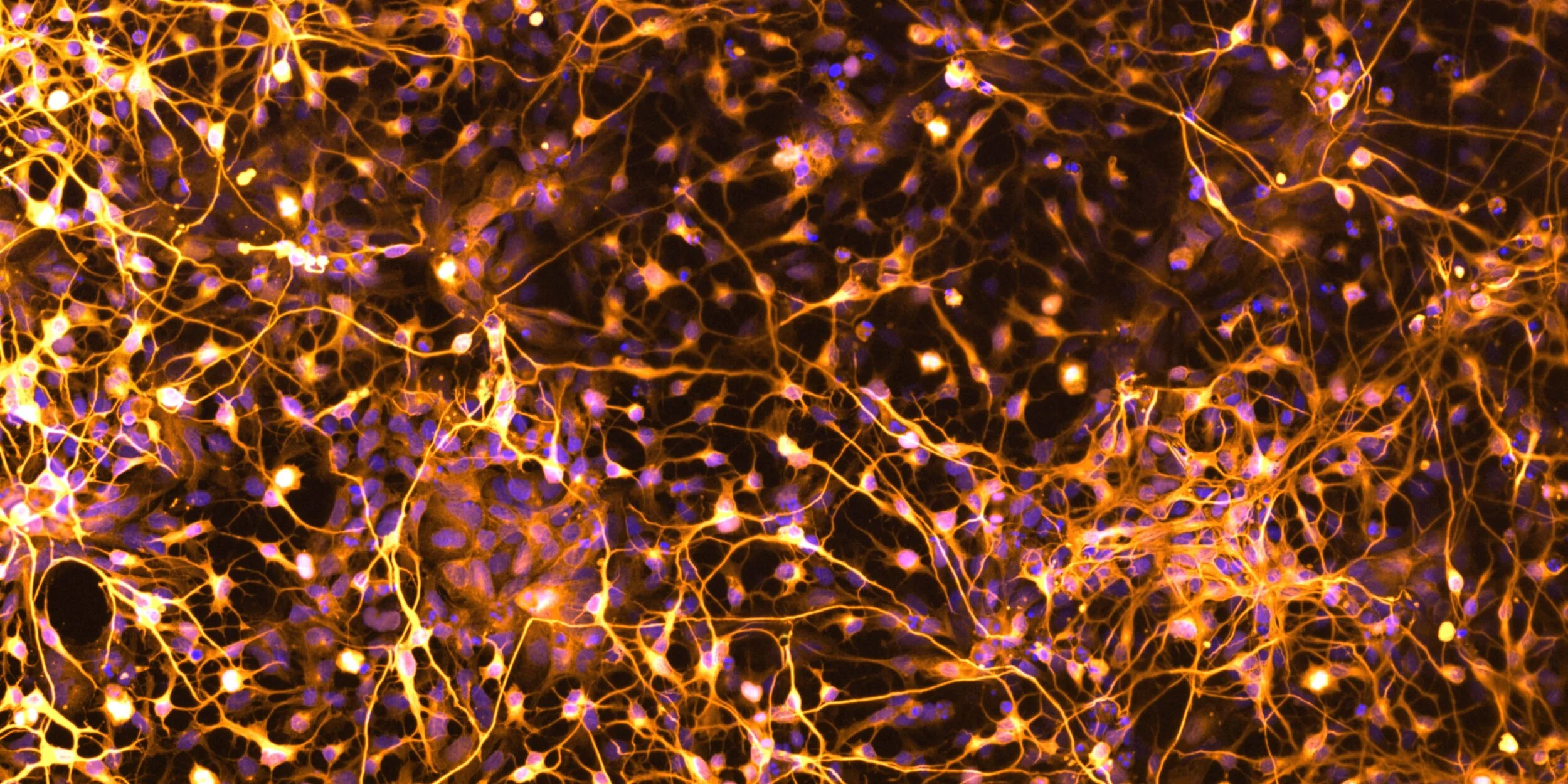 Golden Neurons