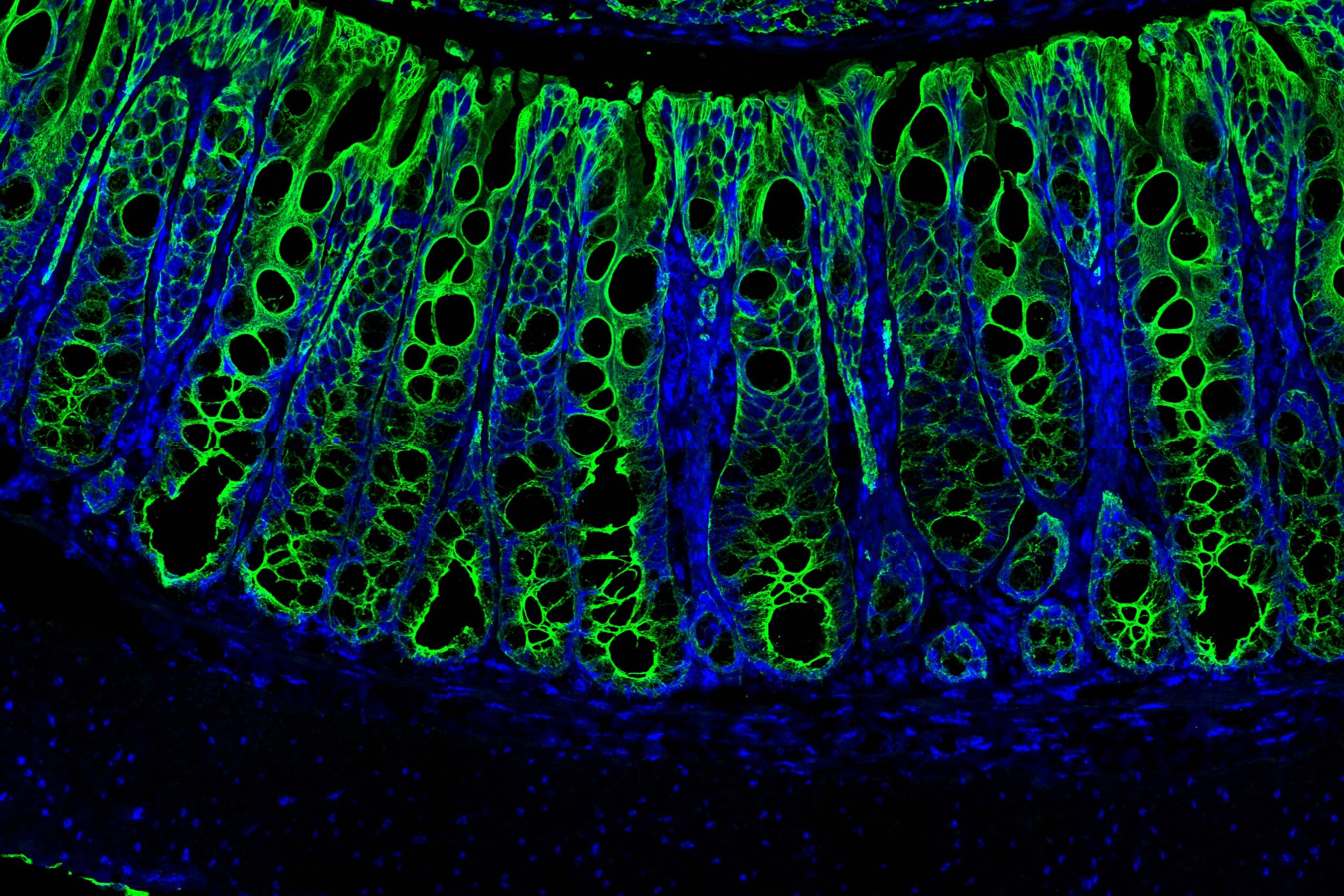 Assessment of cell death in the large intestine following stress