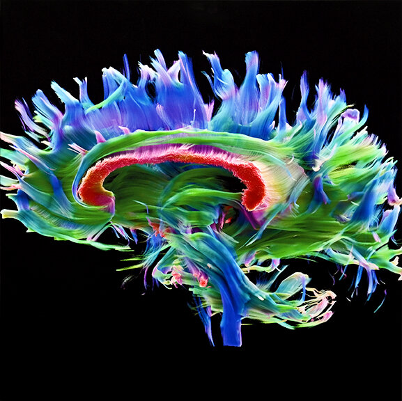 Fiber bundles in the white matter of the human brain