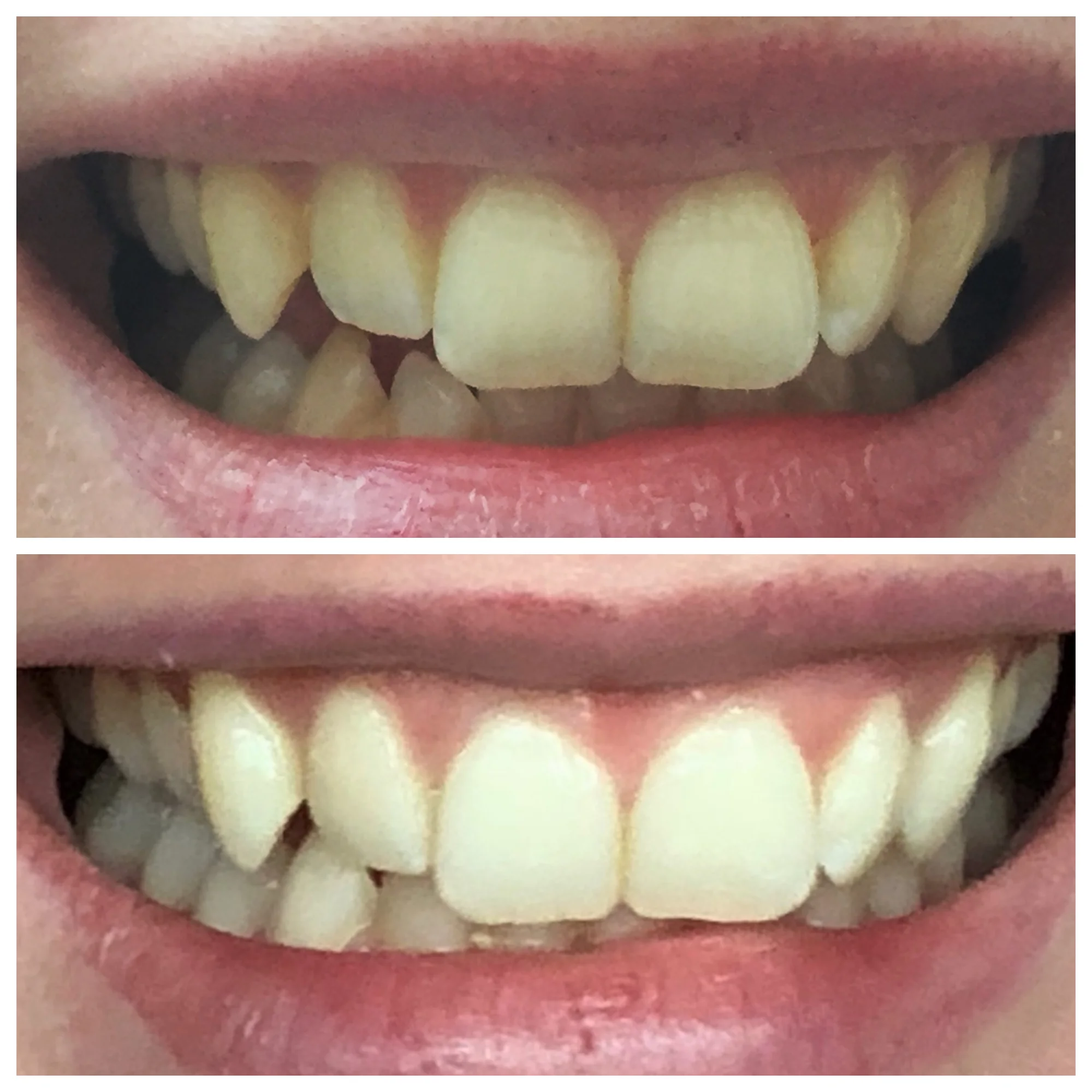 After Photo Stacked.jpg