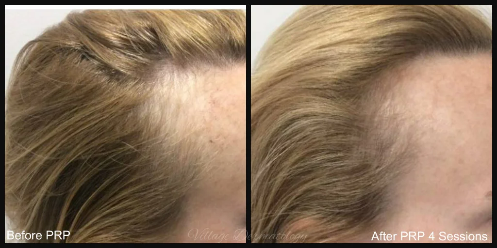 CW before and after.jpg