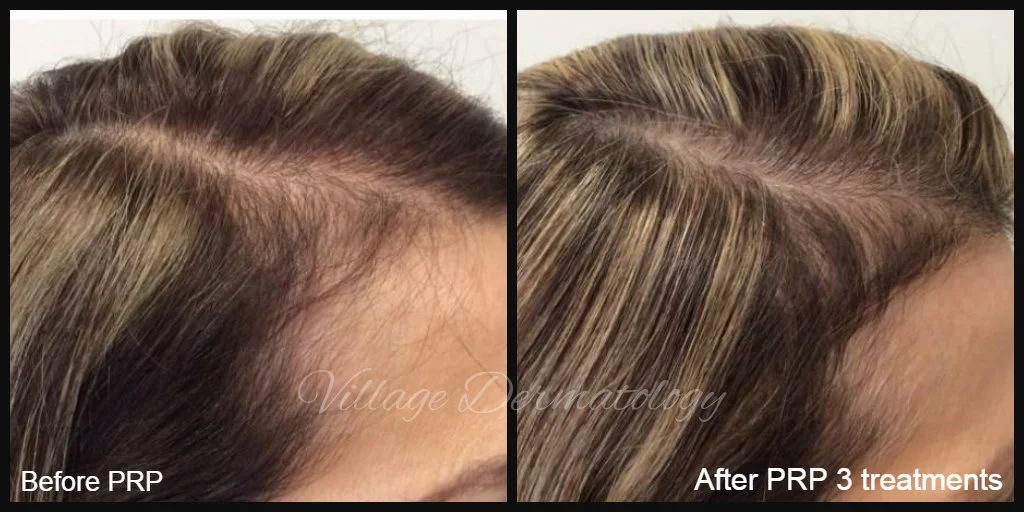 CR before and after.jpg