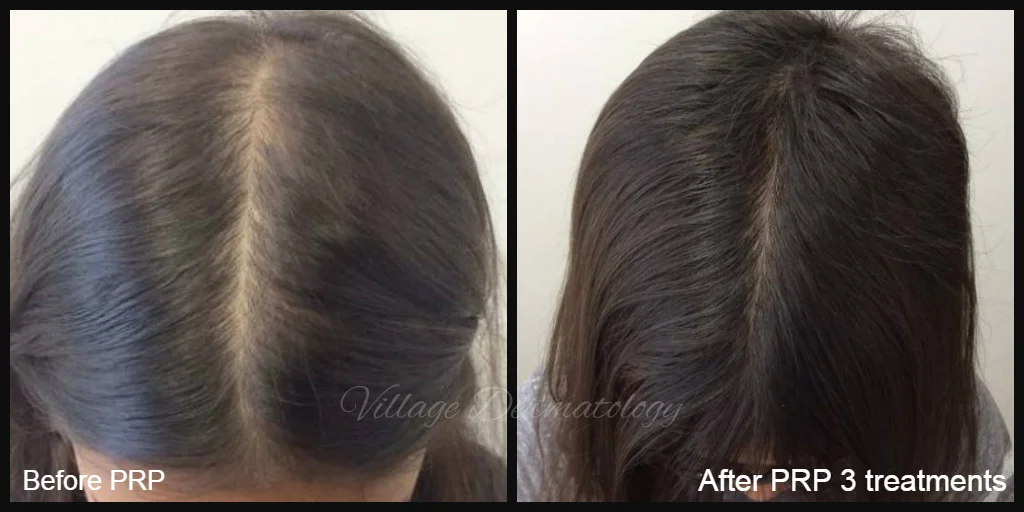 AH before and after.jpg