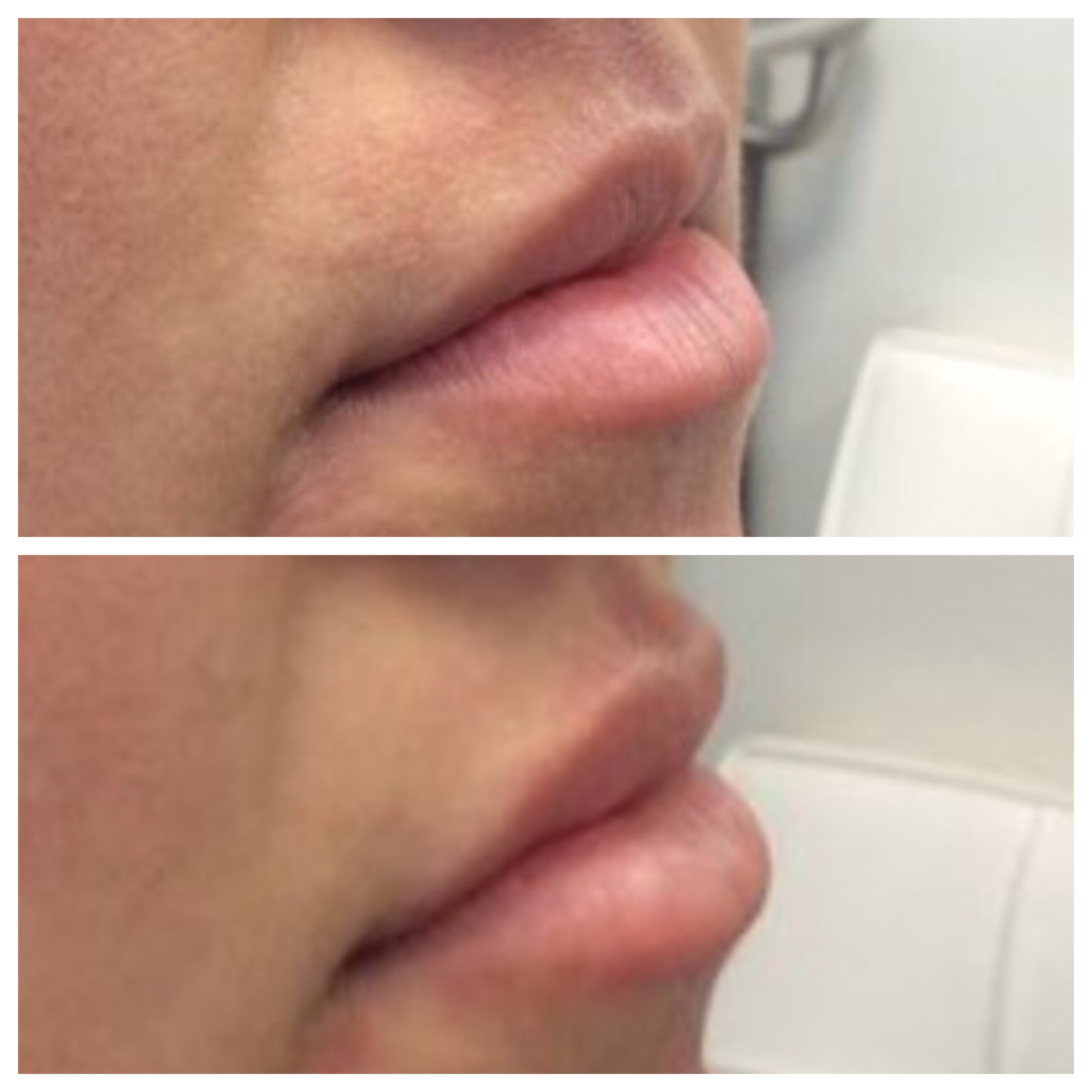 Cosmetic Treatments — Village Dermatology