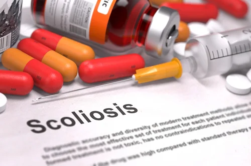 article-050-scoliosis.jpg