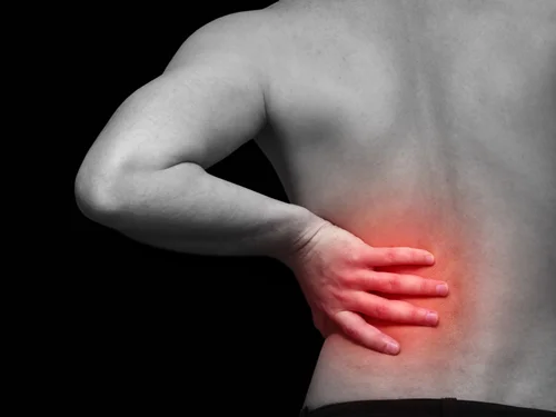 Facet Syndrome Low Back Pain Sydney