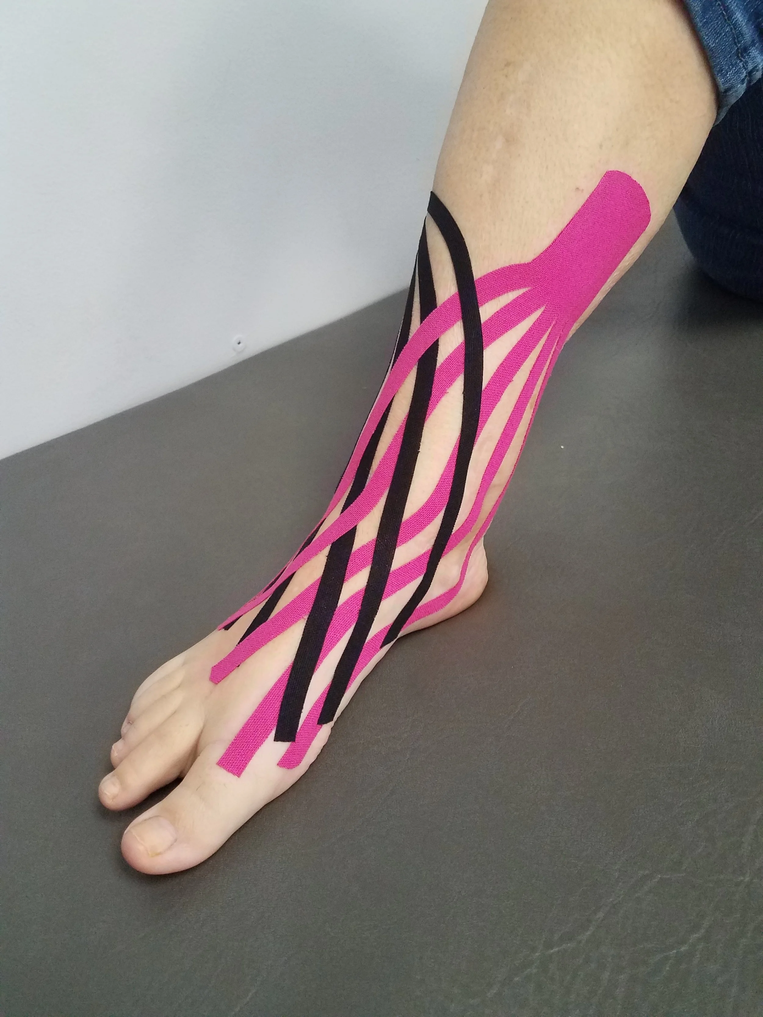 Kinesiology Taping