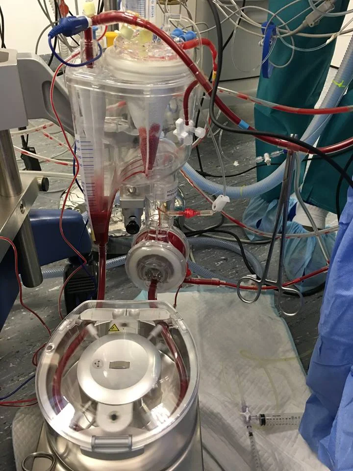The CPB Machine. Oxygenator above, to replace lung function, Main Pump below, to replace heart function.