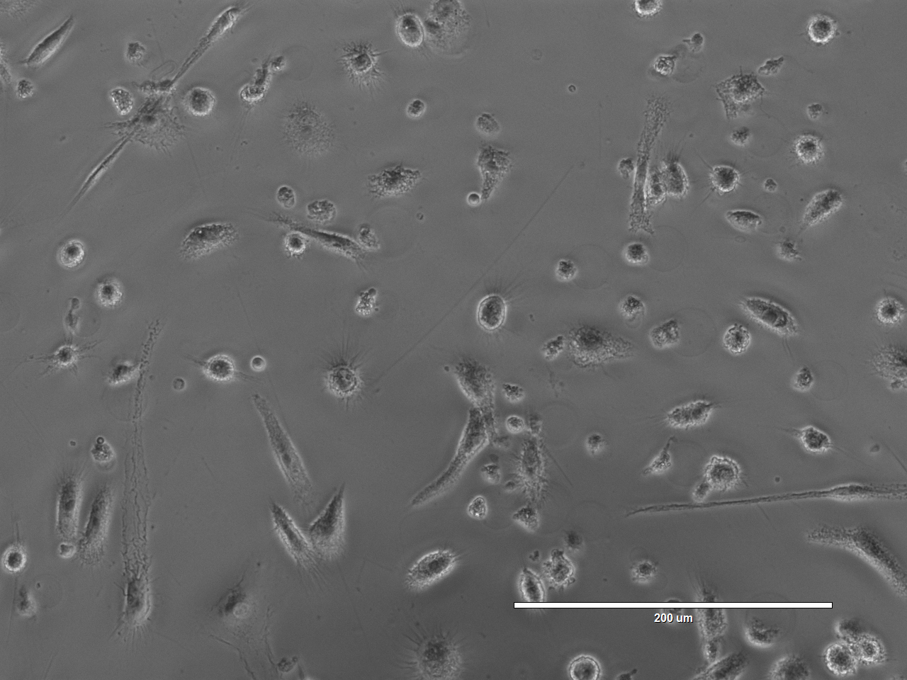 The Pienta laboratory is actively studying how to selectively target M2-tumor associated macrophages for destruction as a therapy for multiple cancers.