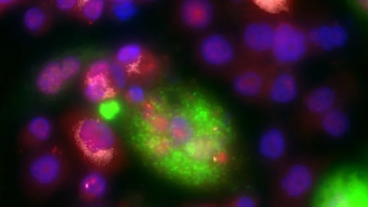 A Keystone Giant Cancer cell. A keystone species is a plant or animal that plays a unique and crucial role in the way an ecosystem functions. These keystone giant cancer cells protect the cancer in times of stress, for example, during chemotherapy treatment.