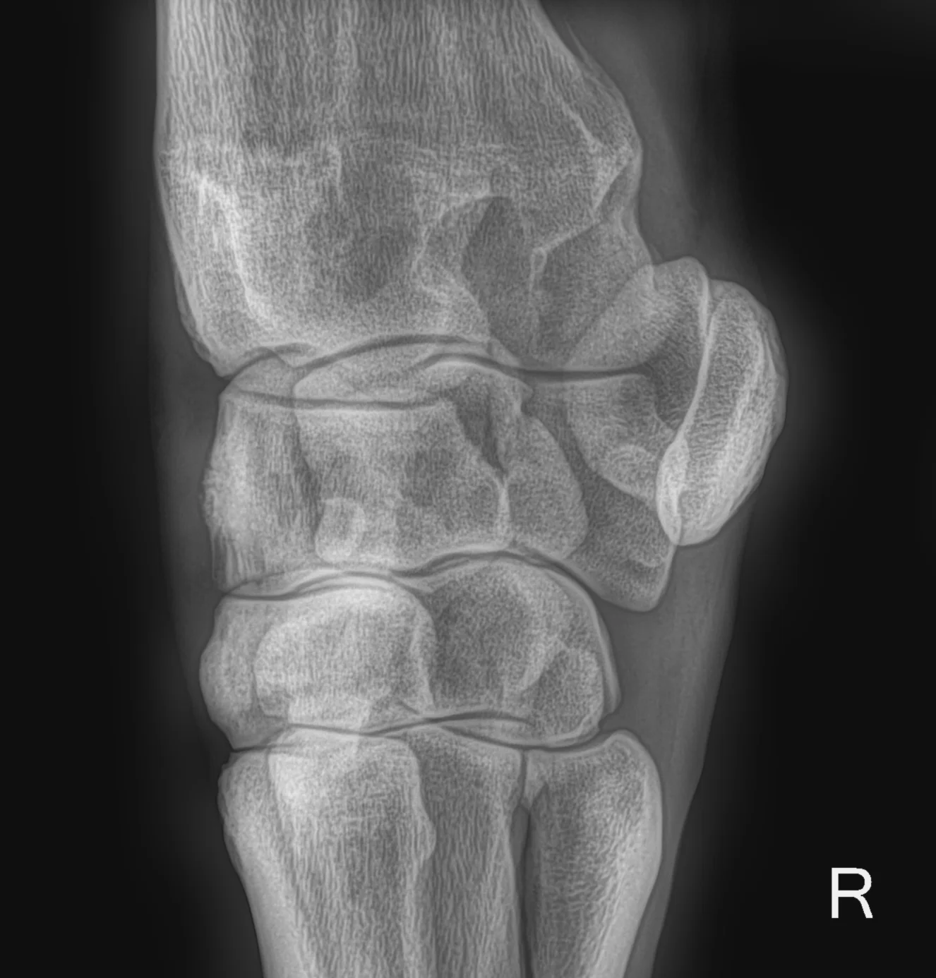 20170114-Screen Shot 2017-01-14 at 12.29.58 PM.jpg