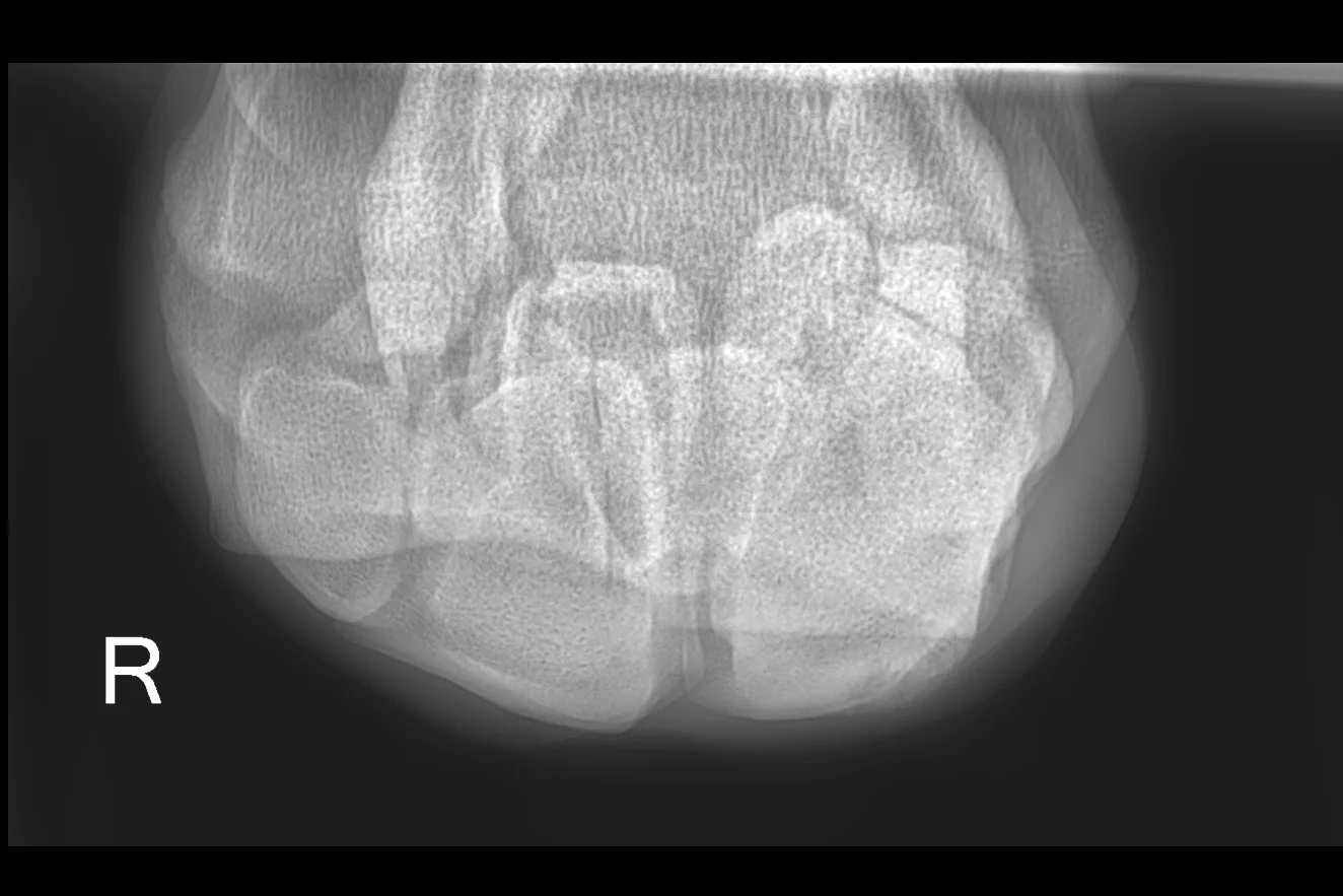 20170114-Screen Shot 2017-01-14 at 12.30.26 PM.jpg