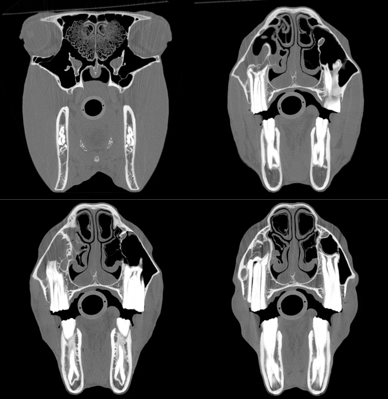 20170203-Skull CT Composite_.jpg