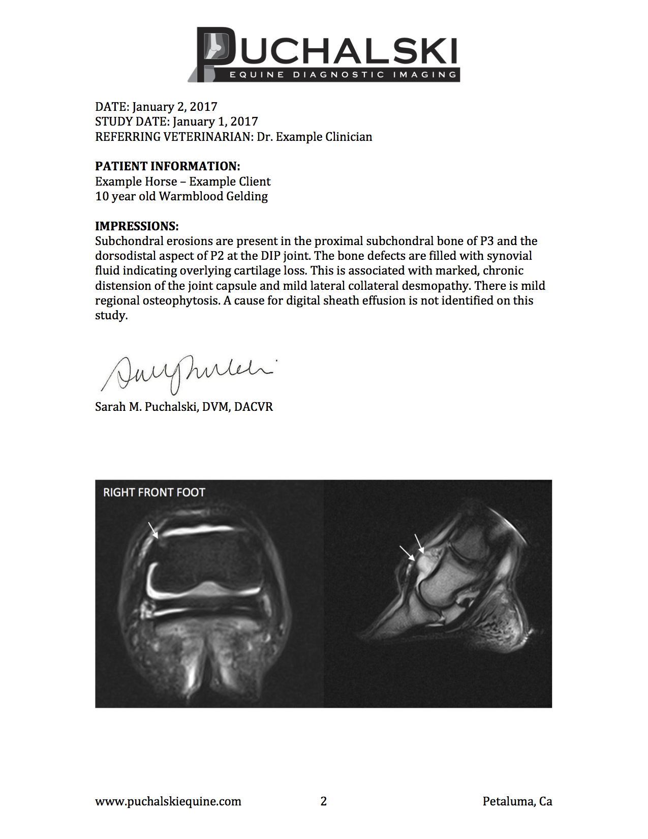 Example MRI Report page 2.jpg