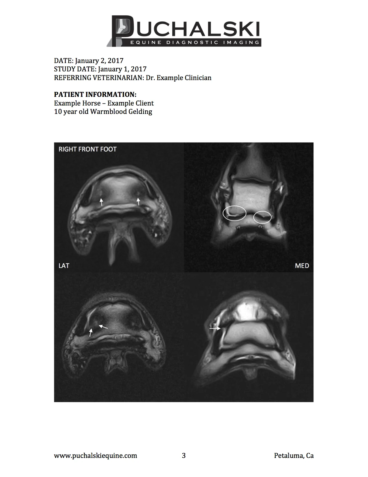 Example MRI Report page 3.jpg