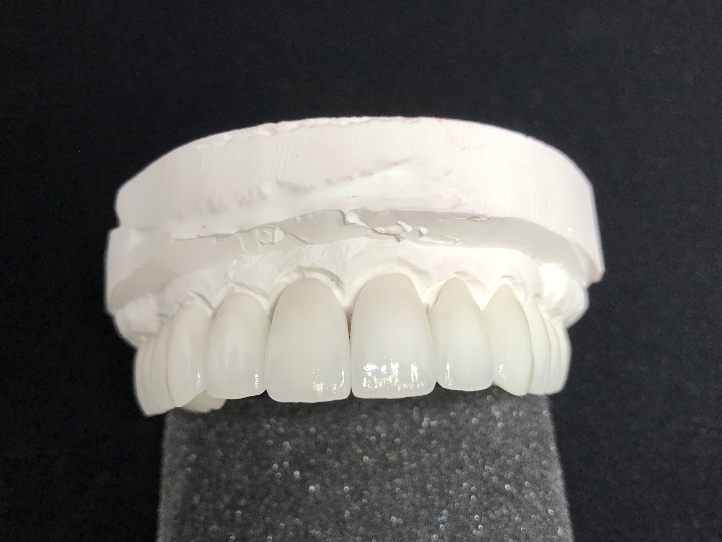 Layered Zirconia