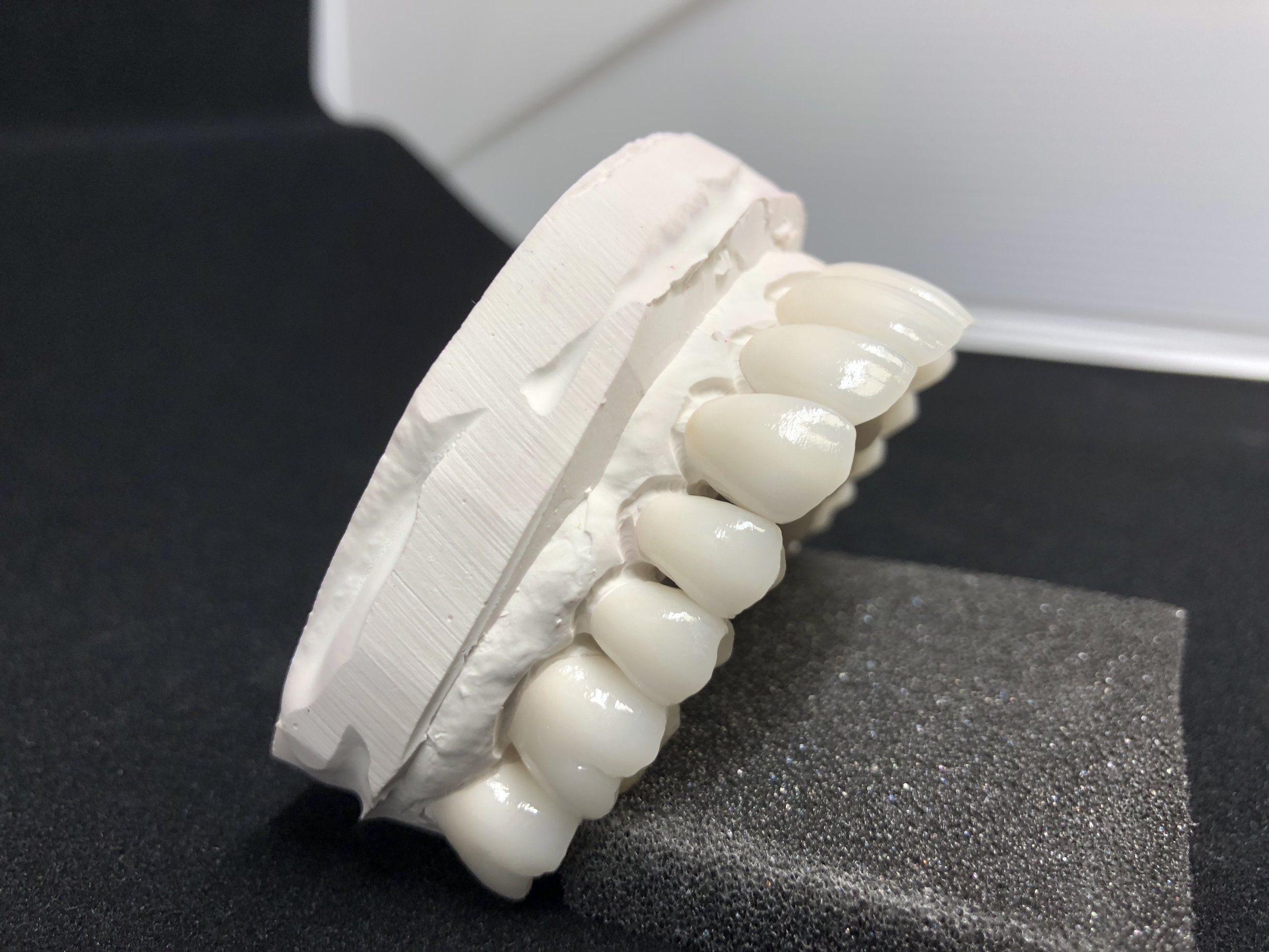 Layered Zirconia