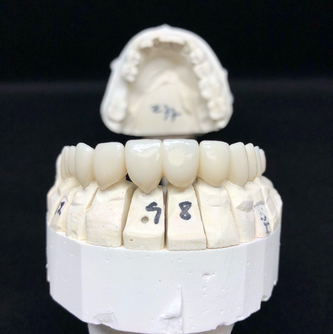 Layered Zirconia