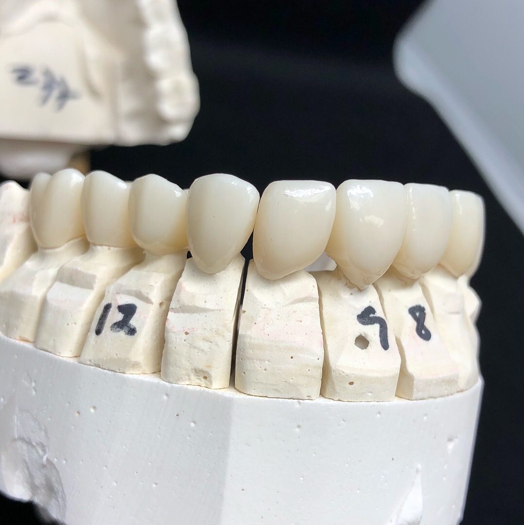 Layered Zirconia