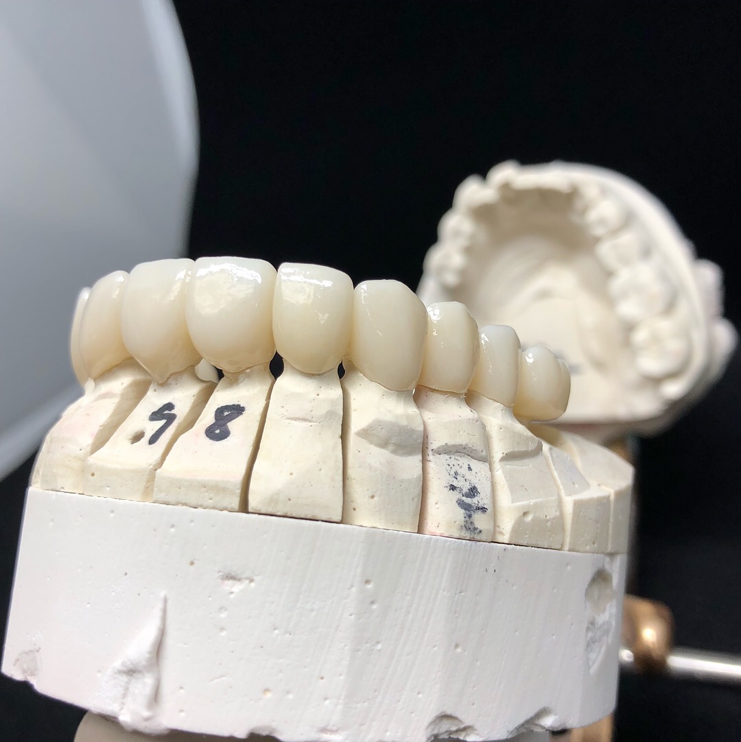 Layered Zirconia