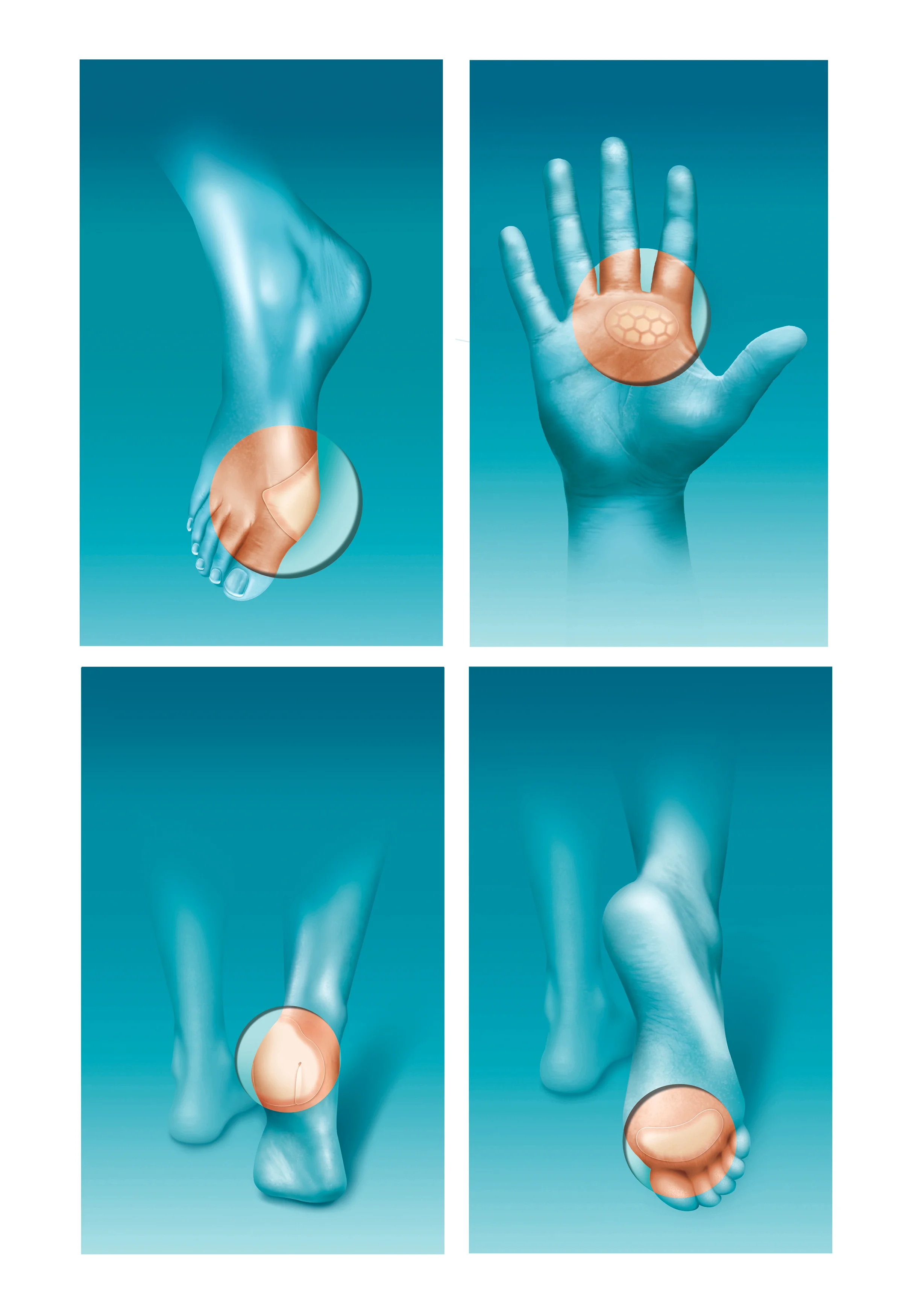 compeed2.jpg