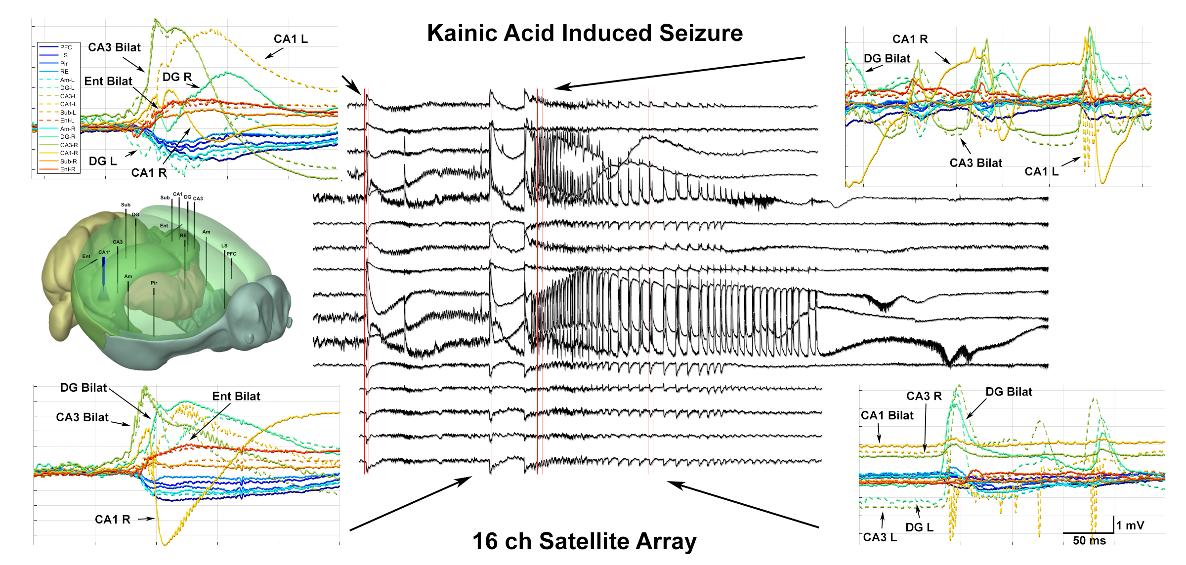 Graph and diagram illustrating kainic acid-induced seizure data with labeled brain regions, EEG waveforms from a 16-channel satellite array, and a 3D brain model indicating electrode placements for measuring seizure activity.