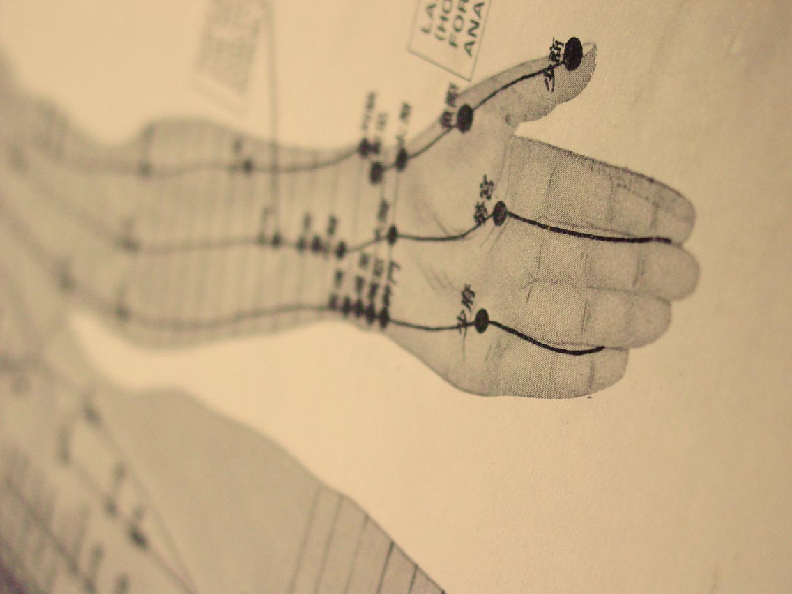 Acupuncture — Acupuncture Off Broad