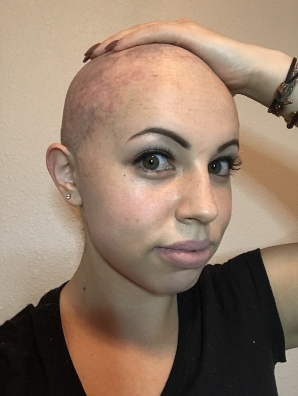 What Happened After I Shaved My Head — Dorin Azérad